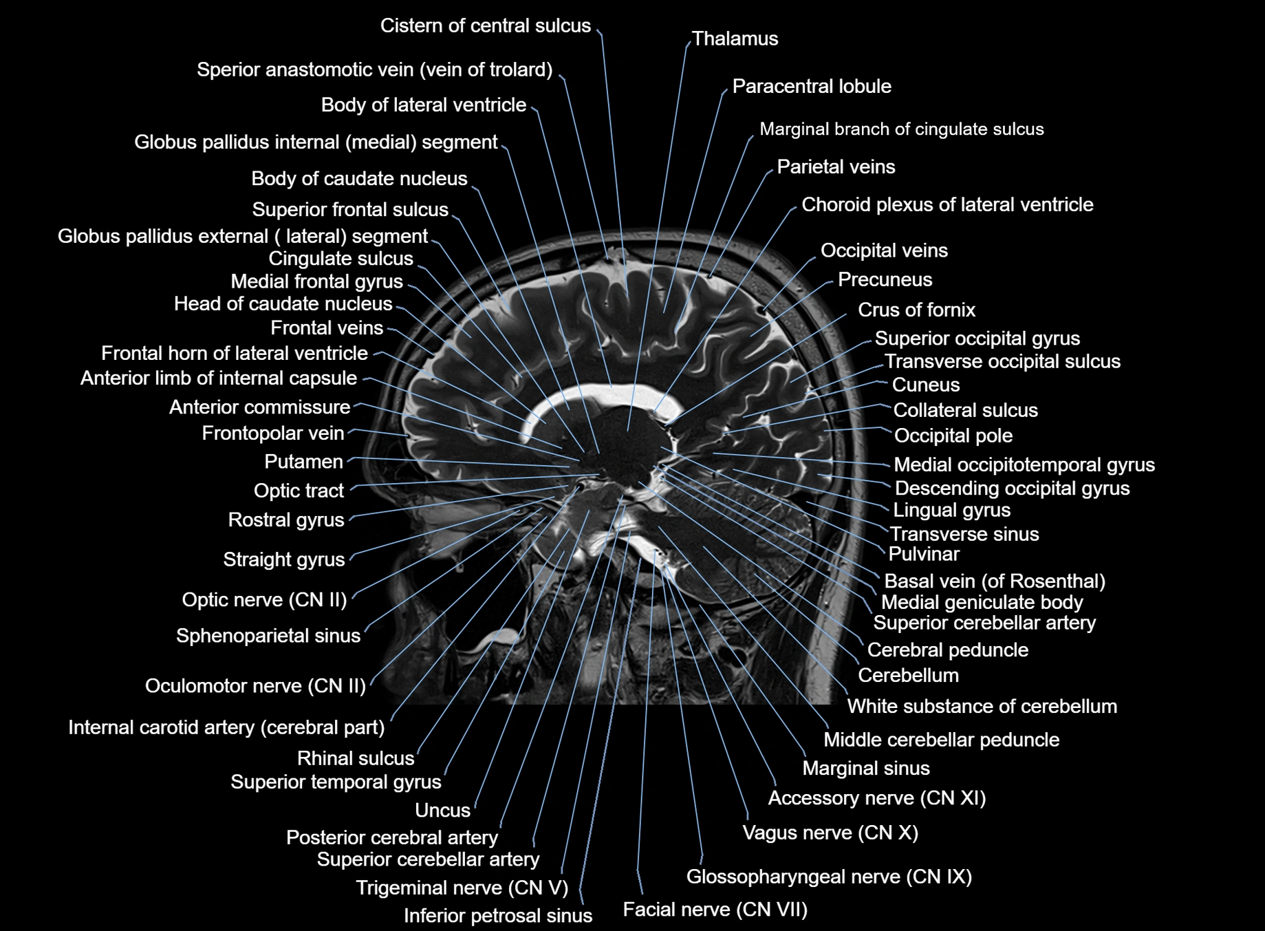 brain sagittal anatomy 3T MRI images -img-00001-00027.webp